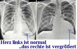 Röntgenuntersuchung 